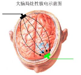 点击查看大图
